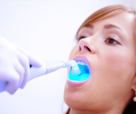 dental fillings